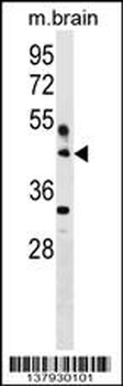 HAPLN4 Antibody (C-term)