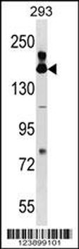 FANCA Antibody (Center)