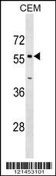 OPTN Antibody (Center)
