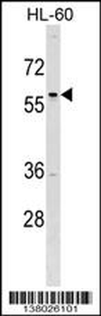 TFAP2D Antibody (C-term)