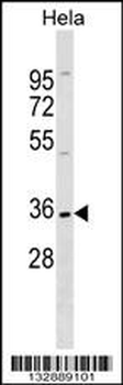 ELOVL1 Antibody (N-term)