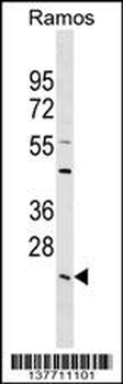 LYPLA2 Antibody (C-term)