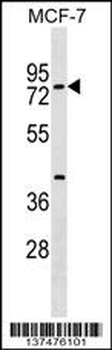 TOX4 Antibody (N-term)