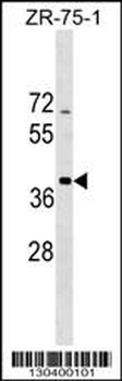 SCO2 Antibody (C-term)