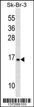 UTS2D Antibody (N-term)