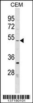 EVI2B Antibody (Center)