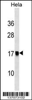 AP2S1 Antibody (Center)