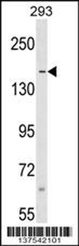 SAFB Antibody (N-term)