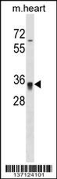 Mouse Hoxc8 Antibody (N-term)