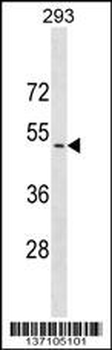 CADM3 Antibody (Center)