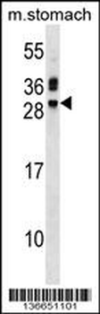 TNNI3 Antibody (Center)