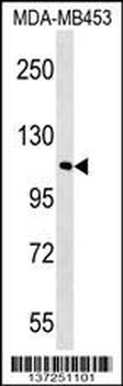 FAM65B Antibody (C-term)