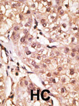 IL29 Antibody (Center)
