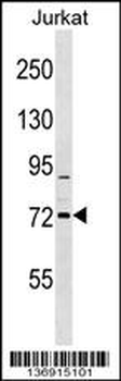 RHOBTB1 Antibody (C-term)