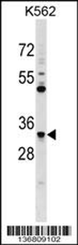 FCN1 Antibody (C-term)