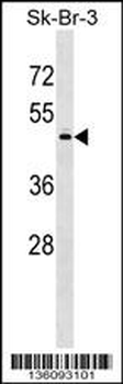 POLS Antibody (Center)