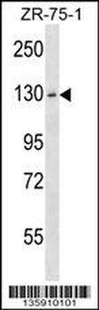 HKDC1 Antibody (C-term)