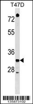 TSFM Antibody (C-term)