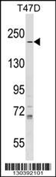 IQGAP1 Antibody (N-term)