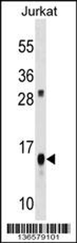 ATP5D Antibody (C-term)