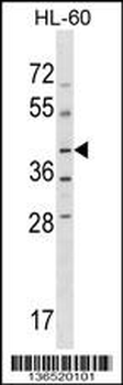 NPRL2 Antibody (C-term)