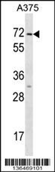 KRT75 Antibody (N-term)
