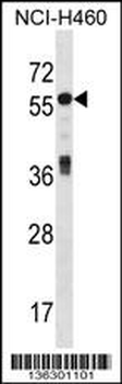 ICA1 Antibody (N-term)