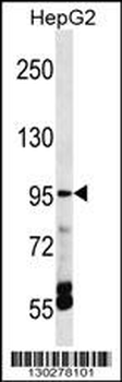 TRPV5 Antibody (C-term)