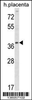 UBE2Q2 Antibody (Center)