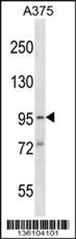 SYDE1 Antibody (N-term)