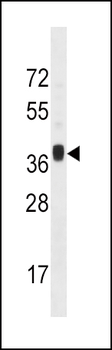 MNX1 Antibody (Center)