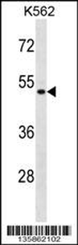 ENOSF1 Antibody (N-term)