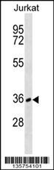 CD226 Antibody (C-term)