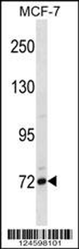 FCRL5 Antibody (Center)