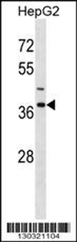 IGBP1 Antibody (Center)