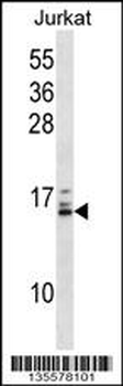 HIST1H2BB/HIST1H2BE Antibody (N-term)