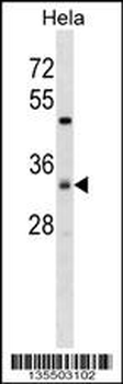 ZDHC7 Antibody (C-term)