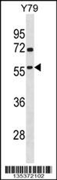 TAF1A Antibody (N-term)