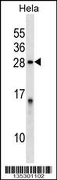 PPP1R2 Antibody (Center)