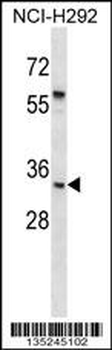 UPK1B Antibody (C-term)