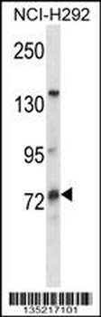 MUM1L1 Antibody (Center)