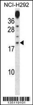 PRR15 Antibody (C-term)