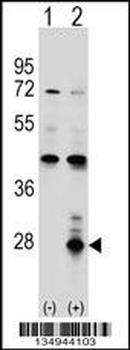 AZU1 Antibody (Center)