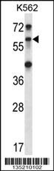 TRIM27 Antibody (C-term)