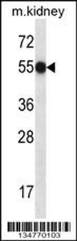 Mouse Fastk Antibody (N-term)
