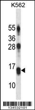 LY86 Antibody (C-term)