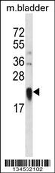 LY86 Antibody (C-term)