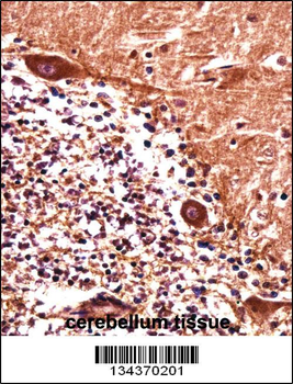 PJA1 Antibody (N-term)