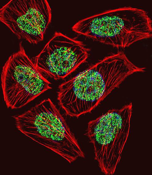 TADA3L Antibody (C-term)