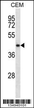 NDRG2 Antibody (N-term)